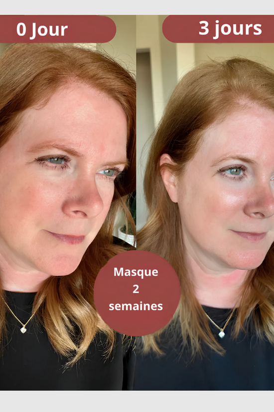 LuminaGlow™-Masque Visage Bio-Collagène