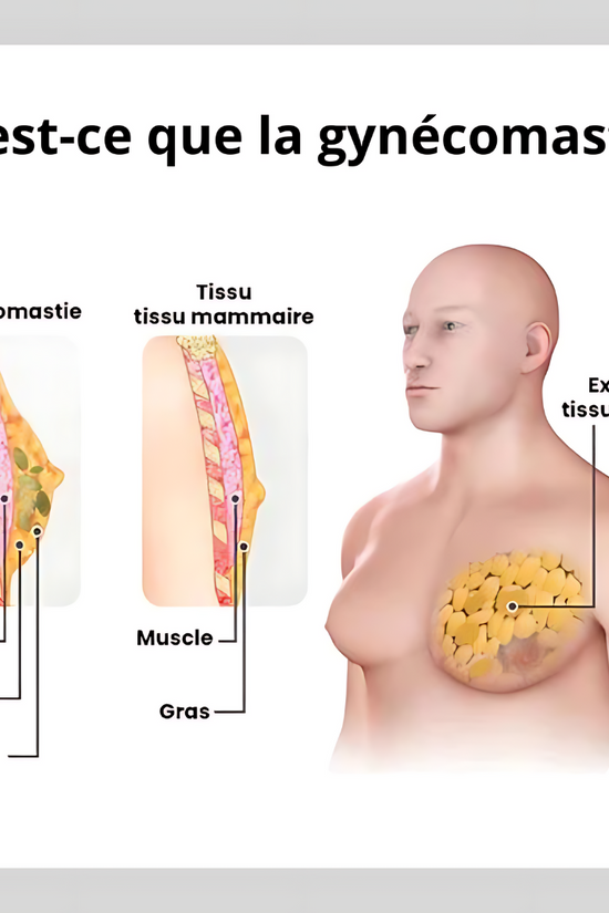 GILET AMINCISSANT | FitForme®
