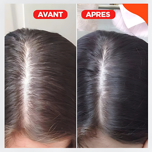Capiluxe™ - Brosse de Massage 3-en-1 - Stimulation Capillaire et Soin