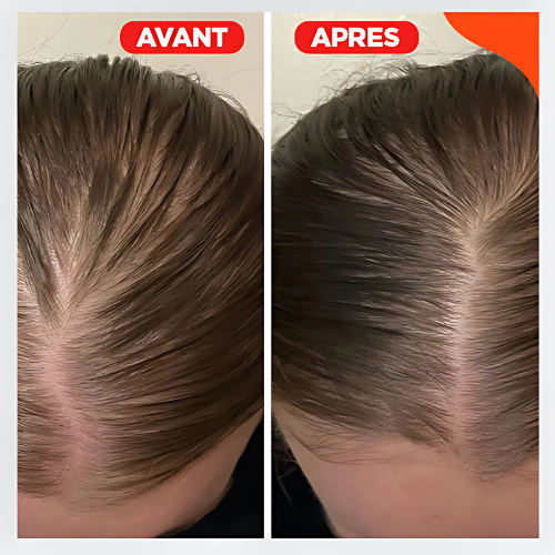 Capiluxe™ - Brosse de Massage 3-en-1 - Stimulation Capillaire et Soin